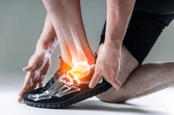Ankle & Foot Pain Management----------12