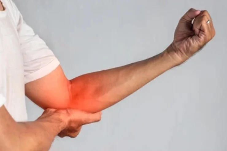 Elbow Pain Management