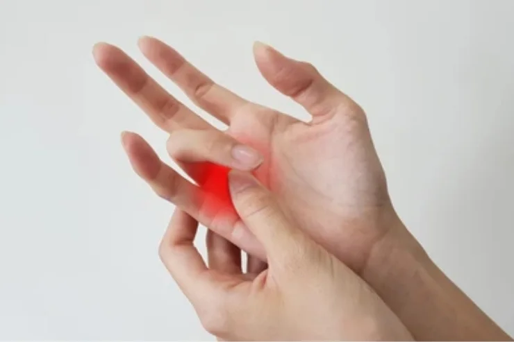 Trigger Finger & Tendon Disorders